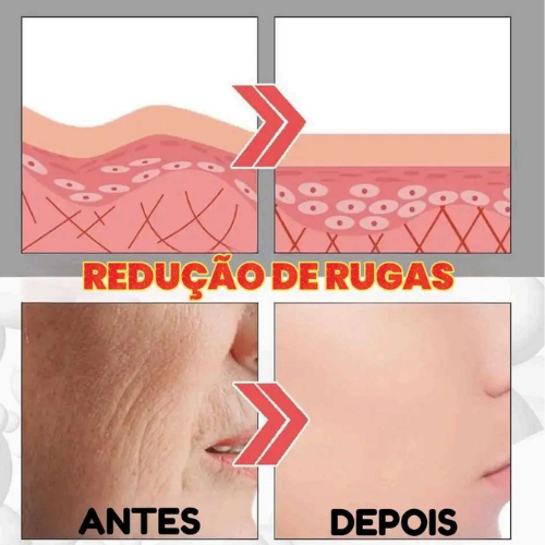 Eelhoe Antienvelhecimento - Efeito Cinderela