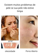 Tratamento Facial 4 em 1 –  ©Lifting Imediato, Firmeza e Cuidado Ocular