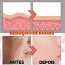 Eelhoe Antienvelhecimento - Efeito Cinderela