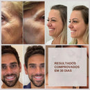 Sérum Renova Anti-Idade – Redutor de Rugas Profundas | Rejuvenescedor Facial Premium