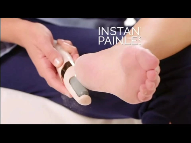 LLIXADOR DE PÉ ELÉTRICO PORTÁTIL – PÉS MACIOS EM MINUTOS!