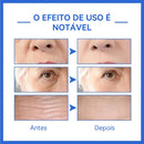 Removedor Instantâneo de Rugas© BOTOX Líquido original Retinol