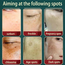 Creme Clareador Intensivo para Manchas Escuras | Pele Uniforme e Radiante