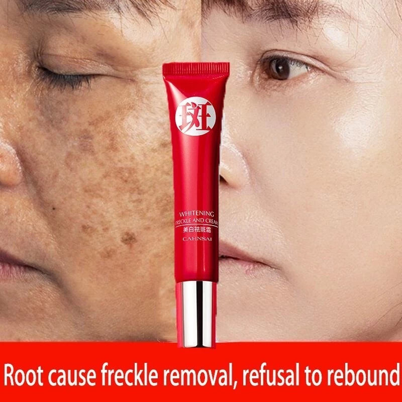 Creme Clareador Intensivo para Manchas Escuras | Pele Uniforme e Radiante