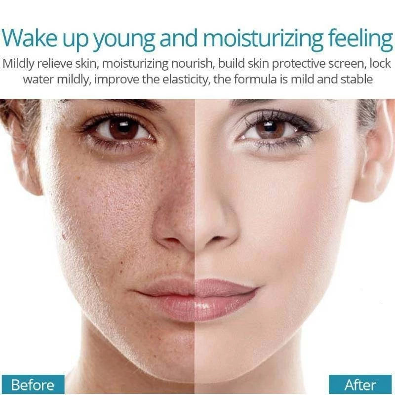 Creme Clareador Intensivo para Manchas Escuras | Pele Uniforme e Radiante