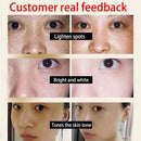 Creme Clareador Intensivo para Manchas Escuras | Pele Uniforme e Radiante