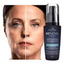 Sérum Renova Anti-Idade – Redutor de Rugas Profundas | Rejuvenescedor Facial Premium